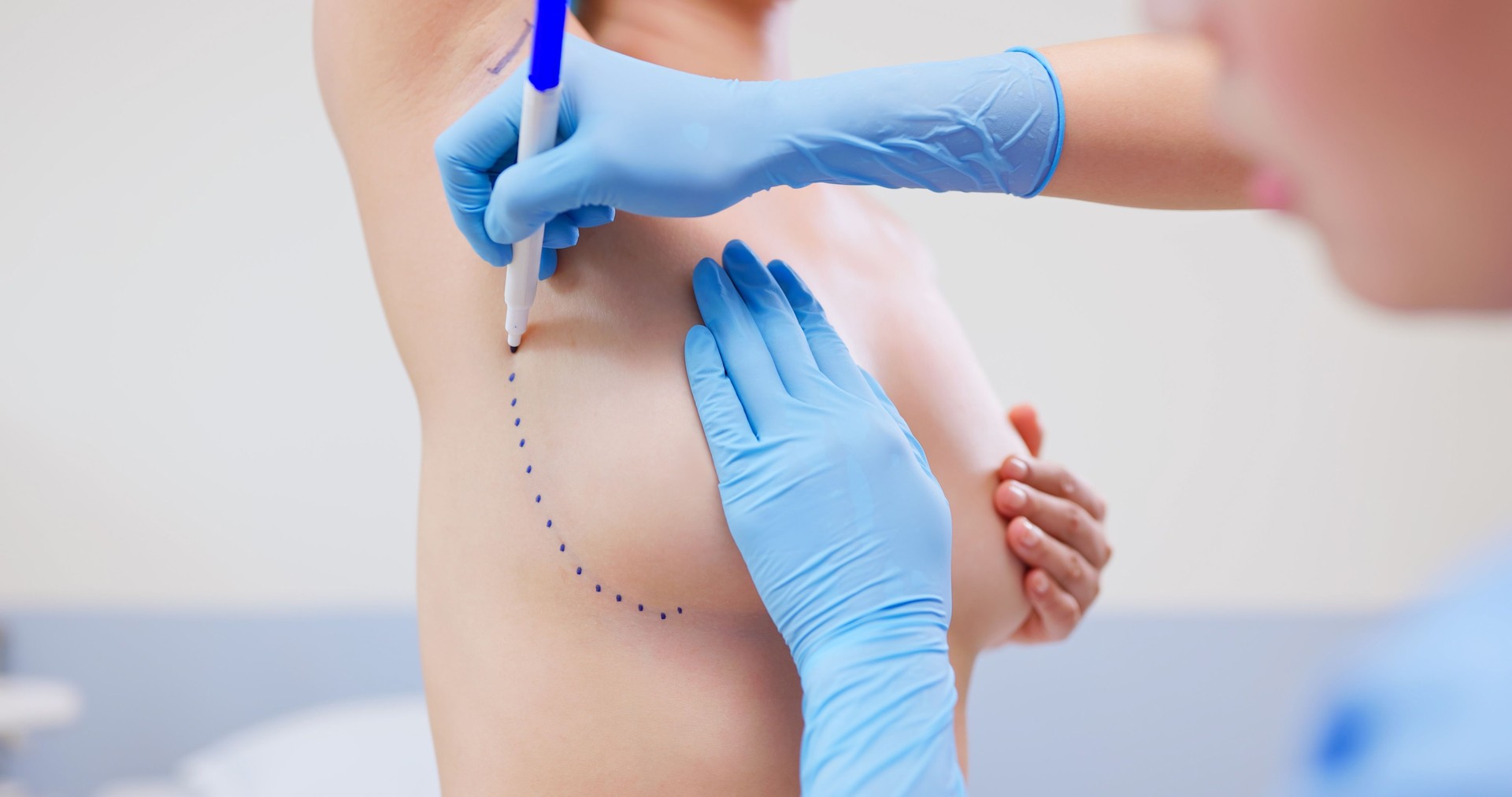 woman breast augmentation surgery