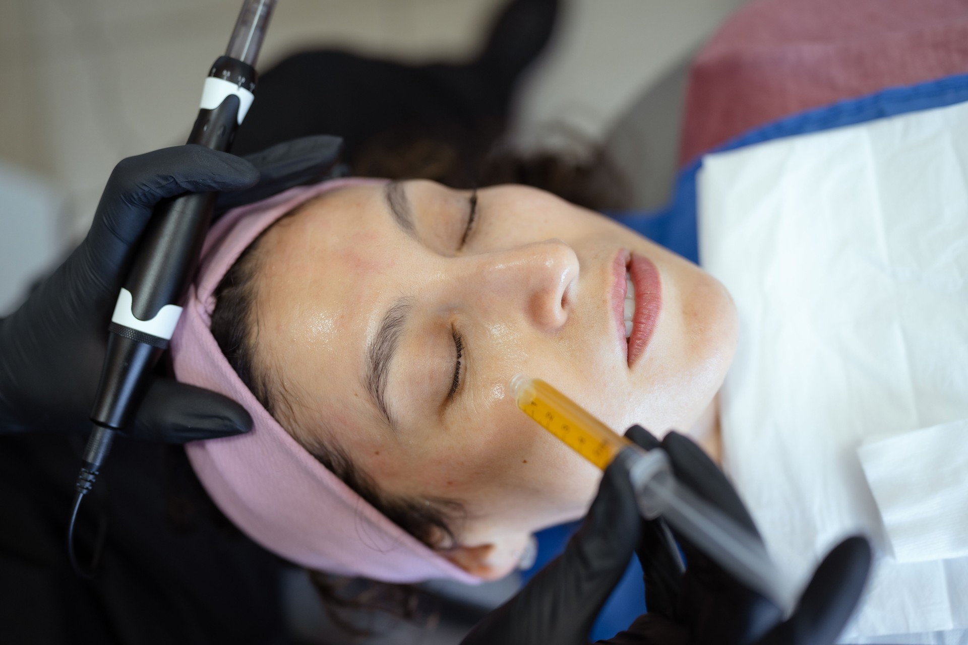 Beautician applying platelet-rich plasma with dermapen for facial rejuvenation
