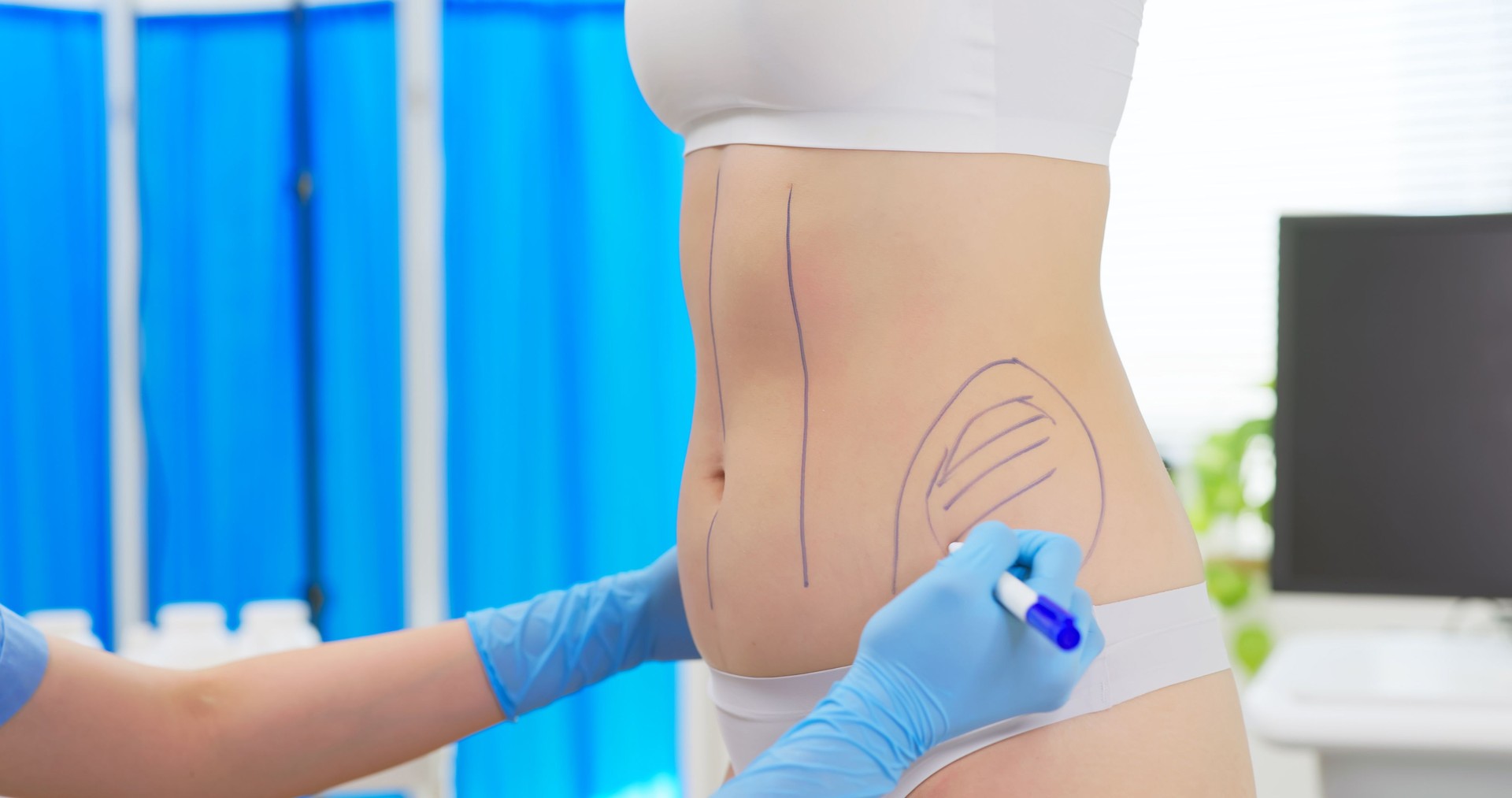 asian woman belly fat examined